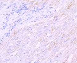 Invitrogen SGCD Recombinant Rabbit Monoclonal Antibody (JM61-10) 100 &mu;L;