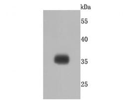 Invitrogen SGCD Recombinant Rabbit Monoclonal Antibody (JM61-10) 100 &mu;L;