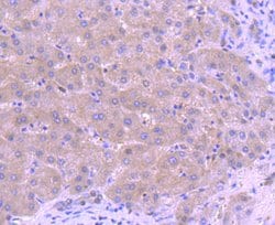 Invitrogen CTCF Recombinant Rabbit Monoclonal Antibody (JM10-61) 100 &mu;L | Buy Online | Invitrogen&trade; | Fisher Scientific