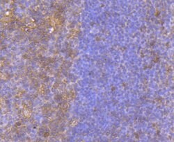Invitrogen BID Recombinant Rabbit Monoclonal Antibody (JM11-14) 100 &mu;L;