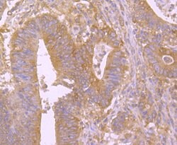 Invitrogen BID Recombinant Rabbit Monoclonal Antibody (JM11-14) 100 &mu;L;