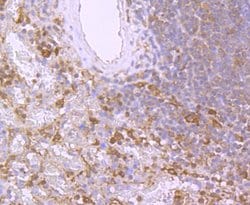 Invitrogen BID Recombinant Rabbit Monoclonal Antibody (JM11-14) 100 &mu;L;