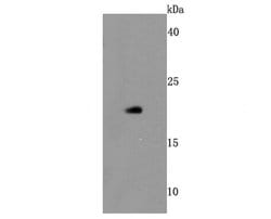 Invitrogen BID Recombinant Rabbit Monoclonal Antibody (JM11-14) 100 &mu;L;