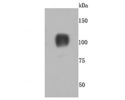 Invitrogen CD26 Recombinant Rabbit Monoclonal Antibody (JM11-42) 100 &mu;L;