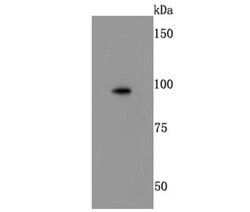 Invitrogen CD18 (LFA-1 beta) Recombinant Rabbit Monoclonal Antibody (JM71-31)