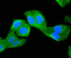 Invitrogen NUR77 Recombinant Rabbit Monoclonal Antibody (JM59-11) 100 &mu;L;