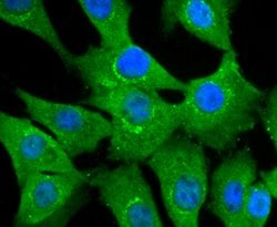 Invitrogen NUR77 Recombinant Rabbit Monoclonal Antibody (JM59-11) 100 &mu;L;