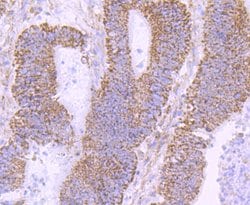 Invitrogen NUR77 Recombinant Rabbit Monoclonal Antibody (JM59-11) 100 &mu;L;