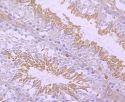Invitrogen NUR77 Recombinant Rabbit Monoclonal Antibody (JM59-11) 100 &mu;L;