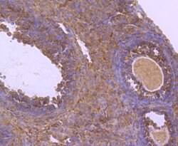 Invitrogen NUR77 Recombinant Rabbit Monoclonal Antibody (JM59-11) 100 &mu;L;