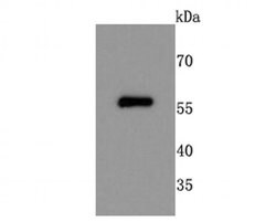 Invitrogen NUR77 Recombinant Rabbit Monoclonal Antibody (JM59-11) 100 &mu;L;