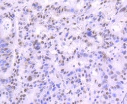 Invitrogen MRE11 Recombinant Rabbit Monoclonal Antibody (JM11-18) 100 μL;