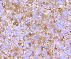 Invitrogen FGF21 Recombinant Rabbit Monoclonal Antibody (JA10-97) 100 &mu;L;