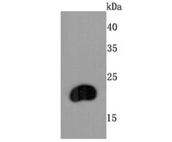 Invitrogen FGF21 Recombinant Rabbit Monoclonal Antibody (JA10-97) 100 &mu;L;