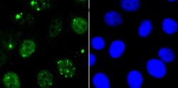 53BP1 Recombinant Rabbit Monoclonal Antibody (JA66-11), Invitrogen 100