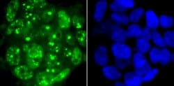 53BP1 Recombinant Rabbit Monoclonal Antibody (JA66-11), Invitrogen 100