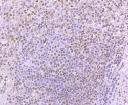 53BP1 Recombinant Rabbit Monoclonal Antibody (JA66-11), Invitrogen 100