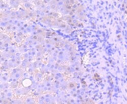 53BP1 Recombinant Rabbit Monoclonal Antibody (JA66-11), Invitrogen 100