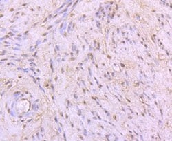 53BP1 Recombinant Rabbit Monoclonal Antibody (JA66-11), Invitrogen 100