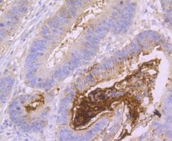 Invitrogen MUC2 Recombinant Rabbit Monoclonal Antibody (JA10-92) 100 &mu;L | Buy Online | Invitrogen&trade; | Fisher Scientific