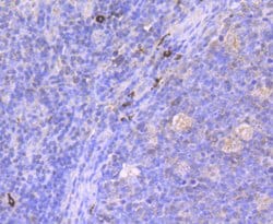 Invitrogen MUC2 Recombinant Rabbit Monoclonal Antibody (JA10-92) 100 &mu;L | Buy Online | Invitrogen&trade; | Fisher Scientific