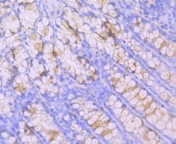 Invitrogen MUC2 Recombinant Rabbit Monoclonal Antibody (JA10-92) 100 &mu;L | Buy Online | Invitrogen&trade; | Fisher Scientific