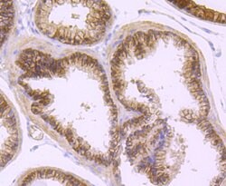 Invitrogen DCLK1 Recombinant Rabbit Monoclonal Antibody (JA11-03) 100 &mu;L;