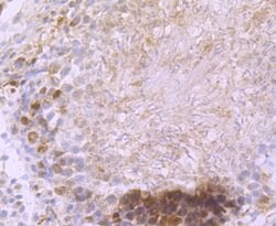 Invitrogen DCLK1 Recombinant Rabbit Monoclonal Antibody (JA11-03) 100 &mu;L;