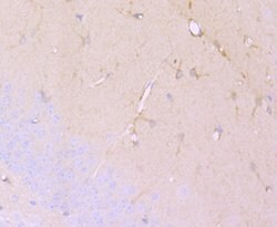 Invitrogen DCLK1 Recombinant Rabbit Monoclonal Antibody (JA11-03) 100 &mu;L;