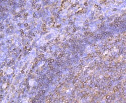 Invitrogen HLA-DPB1 Recombinant Rabbit Monoclonal Antibody (JA10-94) 100
