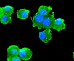 Invitrogen ChAT Recombinant Rabbit Monoclonal Antibody (JA67-11) 100 &mu;L | Buy Online | Invitrogen&trade; | Fisher Scientific
