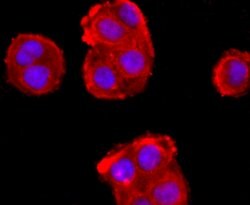 Invitrogen ADFP Recombinant Rabbit Monoclonal Antibody (JA31-81) 100 &mu;L;
