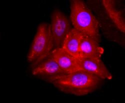 Invitrogen ADFP Recombinant Rabbit Monoclonal Antibody (JA31-81) 100 &mu;L;