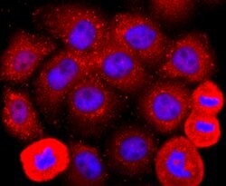 Invitrogen ADFP Recombinant Rabbit Monoclonal Antibody (JA31-81) 100 &mu;L;