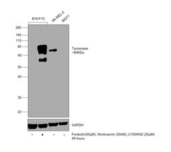 Invitrogen Tyrosinase Recombinant Rabbit Monoclonal Antibody (JA52-11)