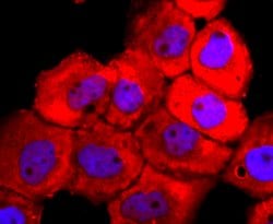 Invitrogen Tyrosinase Recombinant Rabbit Monoclonal Antibody (JA52-11)