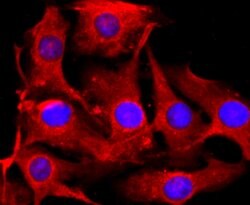 Invitrogen Tyrosinase Recombinant Rabbit Monoclonal Antibody (JA52-11)