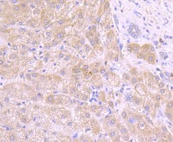 Invitrogen Tyrosinase Recombinant Rabbit Monoclonal Antibody (JA52-11)