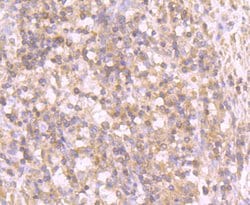 Invitrogen Tyrosinase Recombinant Rabbit Monoclonal Antibody (JA52-11)