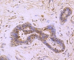 Invitrogen PRMT1 Recombinant Rabbit Monoclonal Antibody (JA11-17) 100 &mu;L | Buy Online | Invitrogen&trade; | Fisher Scientific