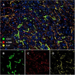 Invitrogen&trade;&nbsp;FAP Recombinant Rabbit Monoclonal Antibody (JA56-11)