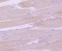 Invitrogen SGCG Recombinant Rabbit Monoclonal Antibody (JA11-57) 100 &mu;L;