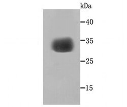 Invitrogen SGCG Recombinant Rabbit Monoclonal Antibody (JA11-57) 100 &mu;L;