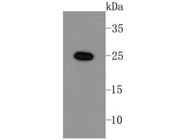 Invitrogen LIN28A Recombinant Rabbit Monoclonal Antibody (JA10-63) 100