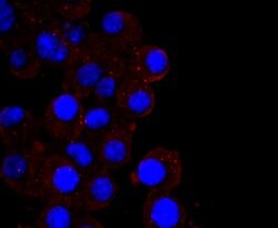 Invitrogen CXCL10 (IP-10) Recombinant Rabbit Monoclonal Antibody (JA10-82)