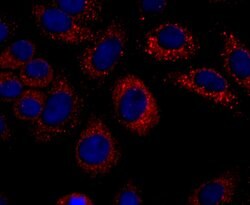 Invitrogen CXCL10 (IP-10) Recombinant Rabbit Monoclonal Antibody (JA10-82)
