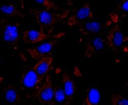 Invitrogen CXCL10 (IP-10) Recombinant Rabbit Monoclonal Antibody (JA10-82)