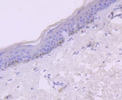 Invitrogen CXCL10 (IP-10) Recombinant Rabbit Monoclonal Antibody (JA10-82)