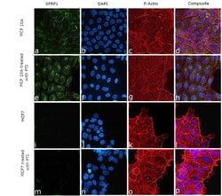 Invitrogen SFRP1 Recombinant Rabbit Monoclonal Antibody (JA11-68) 100 &mu;L;