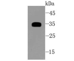 Invitrogen SFRP1 Recombinant Rabbit Monoclonal Antibody (JA11-68) 100 &mu;L;
